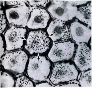 Epidermis - sisteme de corp (histologie)