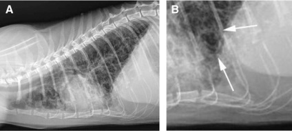 Fibroza pisicilor ușoare X-ray și caracteristicile histopatologice ale nouă pacienți,