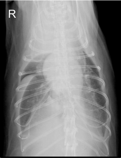Fibroza pisicilor ușoare X-ray și caracteristicile histopatologice ale nouă pacienți,