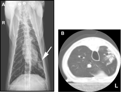 Fibroza pisicilor ușoare X-ray și caracteristicile histopatologice ale nouă pacienți,