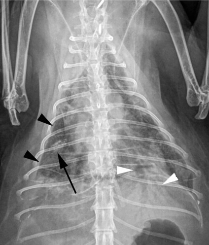 Fibroza pisicilor ușoare X-ray și caracteristicile histopatologice ale nouă pacienți,