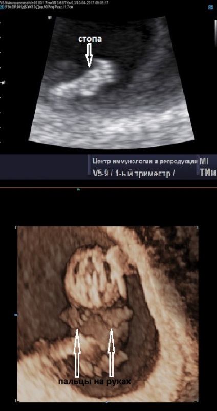 Фото узі при вагітності, фото плода при УЗД під час вагітності