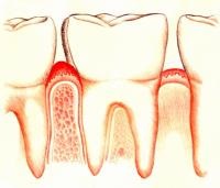 Cum să vă periați dinții pentru a preveni bolile gingiilor