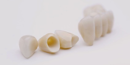 Ce fel de coroane este mai bine să puneți pe dinții de mestecat tipuri de proteze și sfaturi
