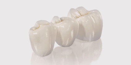 Які коронки краще ставити на жувальні зуби види протезів та поради