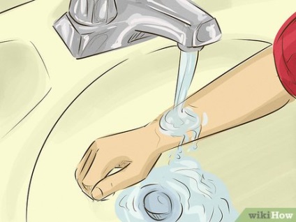 Cum se utilizează aloe pentru arsuri