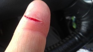 Cum să opriți sângele atunci când tăiați un deget cu un cuțit