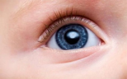 Cum se manifestă angiopatia vaselor retiniene la copii