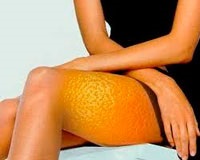 Hogyan lehet eltávolítani a narancsbőr gyorsan otthon