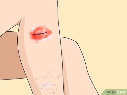 De unde știi dacă pielea ta este sensibilă
