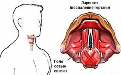 Кашель у тримісячної дитини