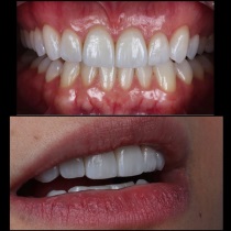 Клініка створення красивої посмішки insmile veneers center