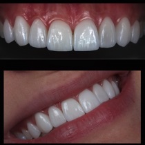 Клініка створення красивої посмішки insmile veneers center