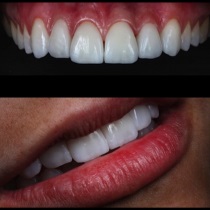 Клініка створення красивої посмішки insmile veneers center