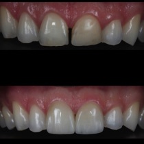 Клініка створення красивої посмішки insmile veneers center