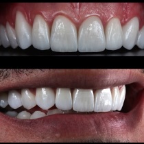 Клініка створення красивої посмішки insmile veneers center