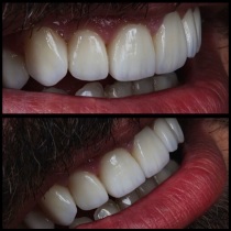 Клініка створення красивої посмішки insmile veneers center