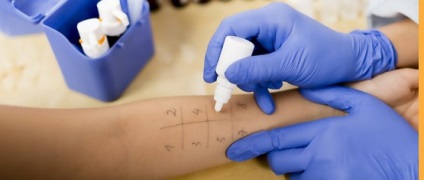 Bőrallergia teszt az érzéstelenítő, anya klinika