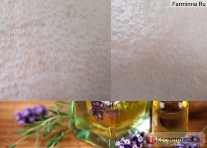 Крем Хімані Бороплюс здорова шкіра антисептичний - «індійський крем на варті здоров'я шкіри