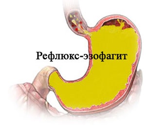 Курорт КМВ хвороби і лікування