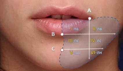 Despre tratamentul traumelor nervului alveolar inferior în implantarea dentară