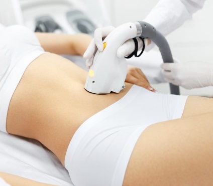 Epilarea laser a abdomenului pentru femei - epilas