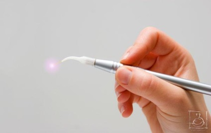 Implantarea cu laser în stomatologie