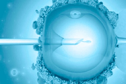 Лікування безпліддя в репродуктивних клініках Європи