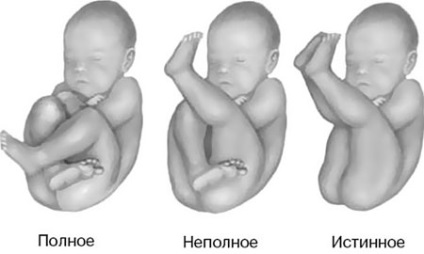 Gyermekek kezelésére bénulás, a gyermek gyógyítása - gyermekbetegségek, konzultációs, szakértői