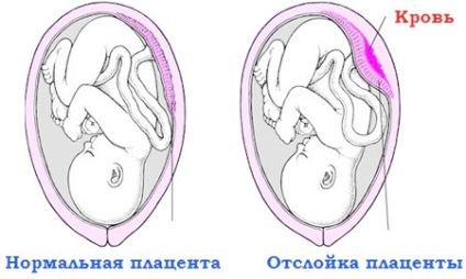 Лікування дітей з ДЦП, лікування дитини - дитячі хвороби, консультації, досвід