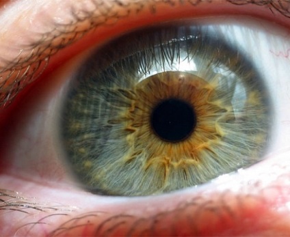 Melanoză a ochiului (melanopatie)
