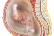 Багатоводдя при вагітності, причини, наслідки