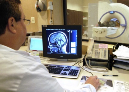 MRI az agyalapi
