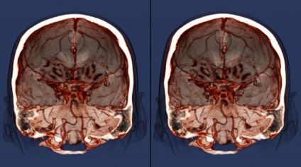 MRI az agy Nyizsnyij Novgorod, ahol az MRI a fej a legjobb áron, a központok kezelése