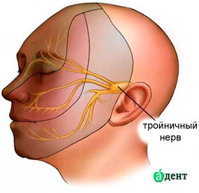 Neuritis a háromosztatú ideg tünetek és a kezelés