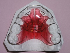 Ортодонтичне лікування в москві