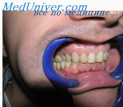 Materiale plastice în chirurgia orală și maxilo-facială