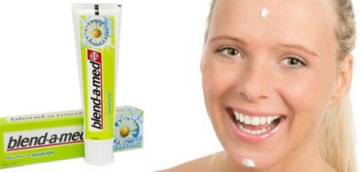 Чи допомагає зубна паста від прищів на обличчі