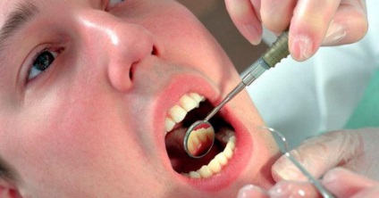 Tisztában vagyunk azzal, hogy miért vérzik mirigyek portál medizona Health (kifutó) Tisztában vagyunk azzal, hogy miért vérzik mirigyek portál medizona egészségügyi
