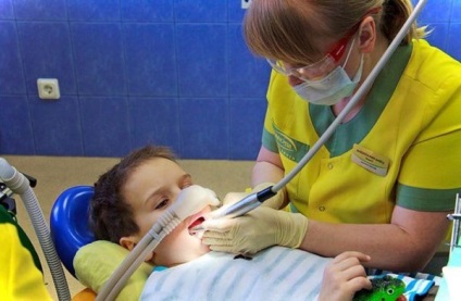 Седация в стоматології для дітей види, особливості, проведення