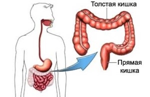 Hány éve él a rákkal után bél műtét nélkül