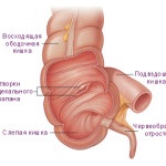 Câți ani trăiesc cu cancer al intestinului după și fără intervenție chirurgicală