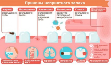 Testați-vă pentru mirosul rău din gură, cum să vă verificați, cauze posibile