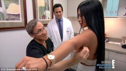 Ezek ikrek legnagyobb intragluteális implantátumok a világon, amelyek készült zsír! Számukra (zsír) Ezek ikrek legnagyobb intragluteális implantátumok a világon, amelyek készült zsír! saját