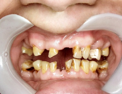 Szolgáltatások és az árak Dental fogorvos IPC