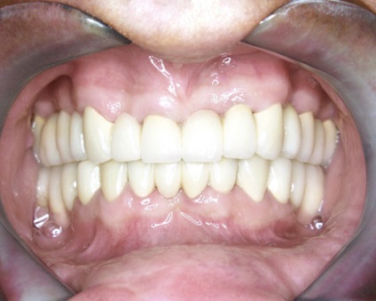 Услуги и цени Dental зъболекар IPC