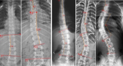 Care este metoda topografiei optice computerizate