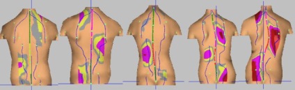 Care este metoda topografiei optice computerizate