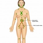 Inflamația ganglionilor limfatici pe gât, secretele medicinei populare