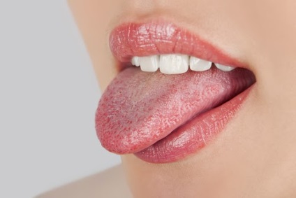 Запалення мови симптоми, ознаки, діагностика та лікування